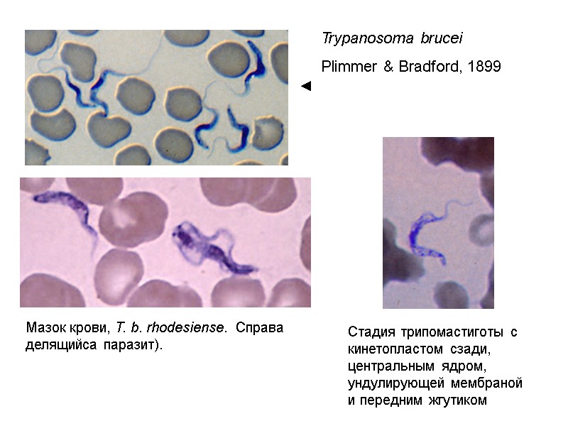 Мазок крови, T. b. rhodesiense.  Справа делящийса паразит).  Стадия трипомастиготы с кинетопластом